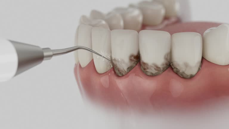 Reliable Dental contractor in Kenton, OH by Dentist Open Now